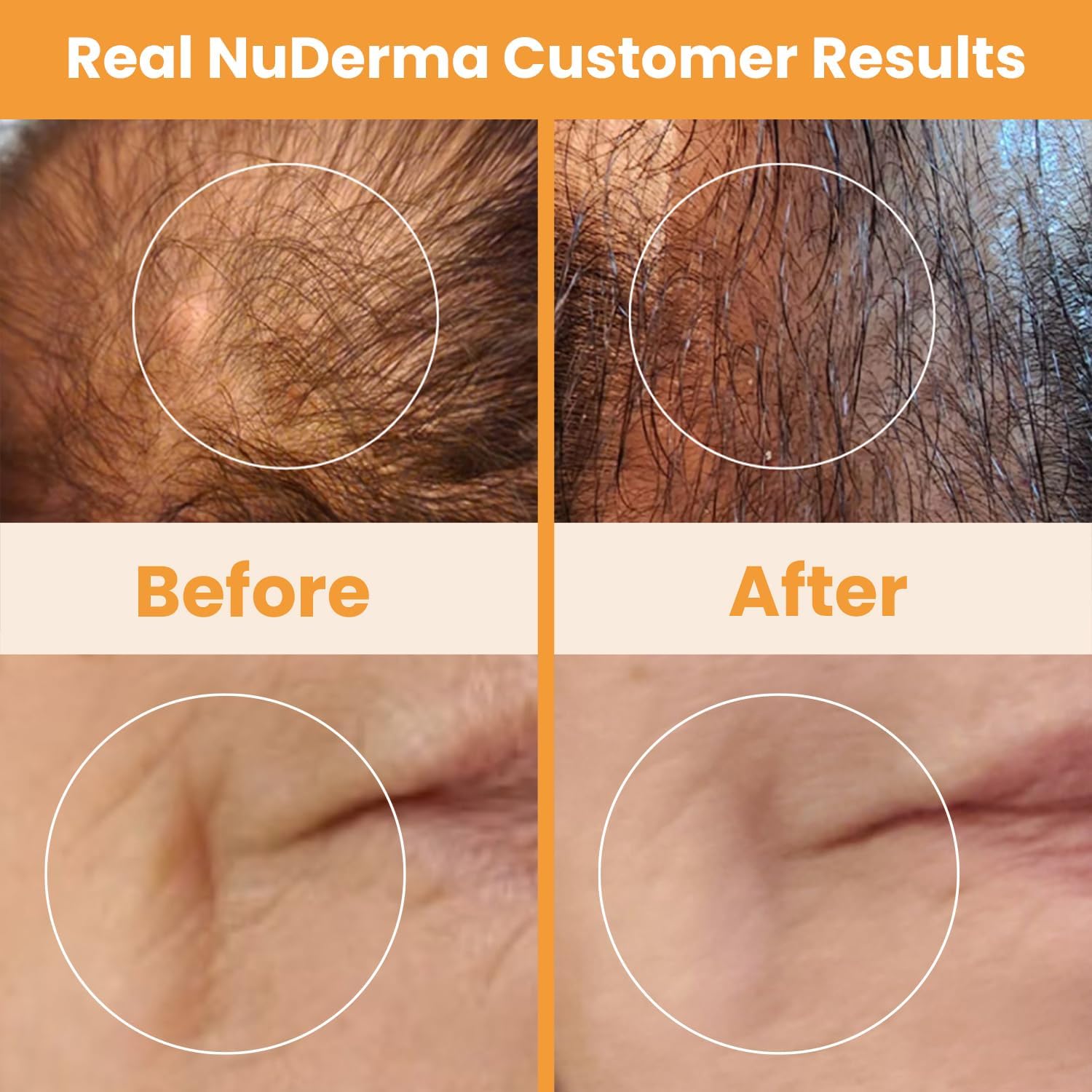 Pure Daily Care NuDerma Wand Hair Care