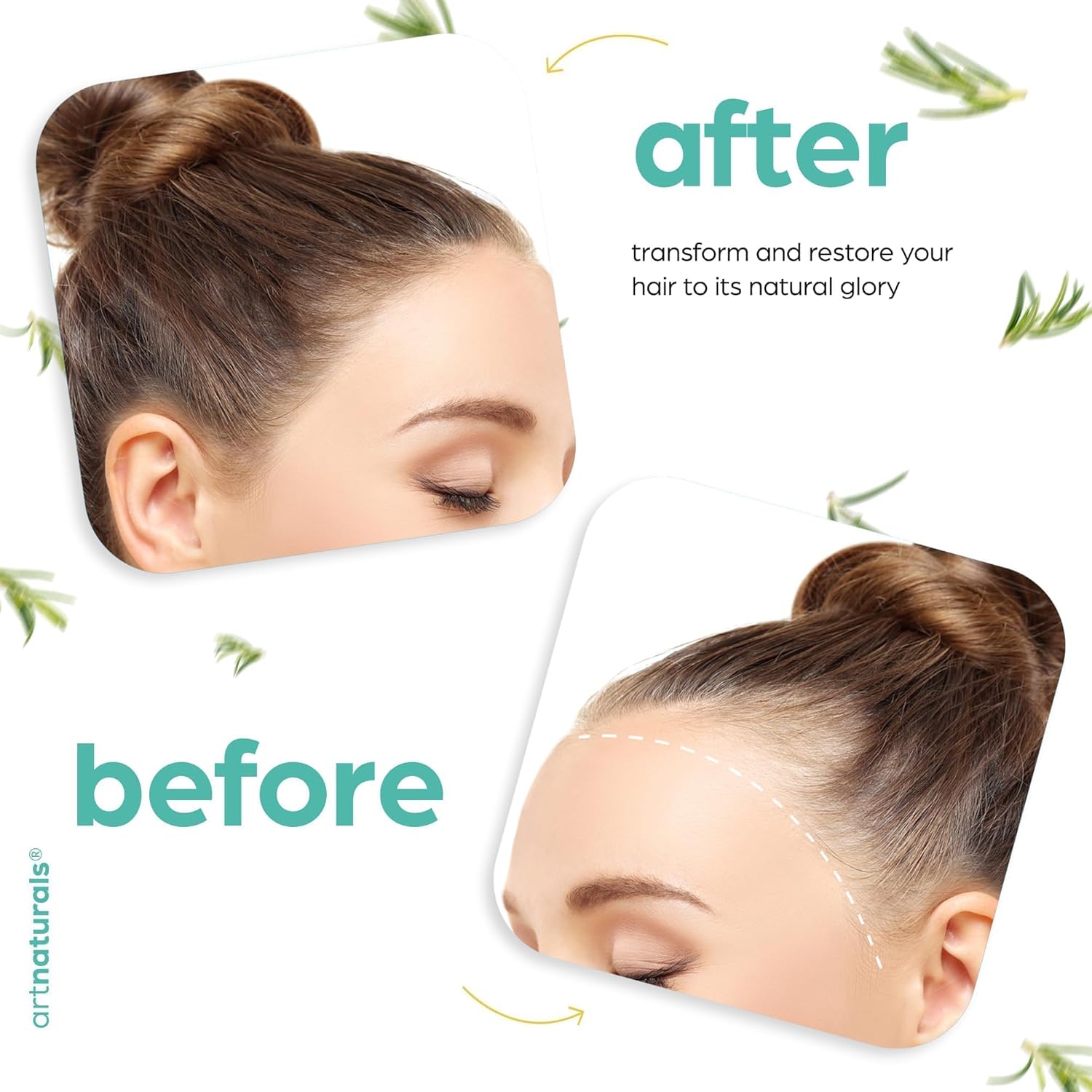 ArtNaturals Organic Rosemary & Castor Hair Growth Oil