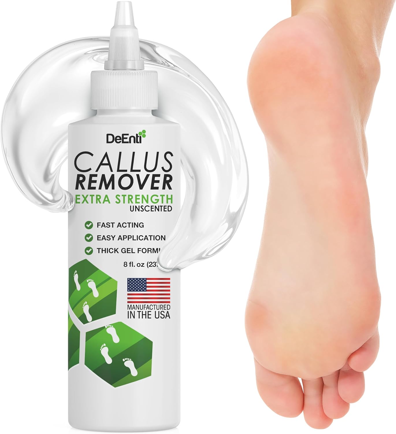 DeEnti Callus Remover for Feet Extra Strength Foot Callus Remover Gel