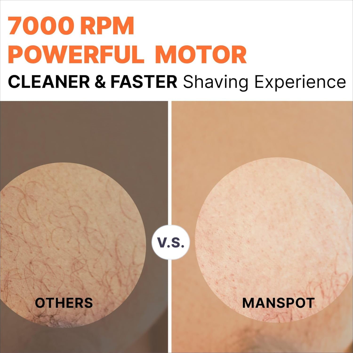 MANSPOT Groin & Body Hair Trimmer