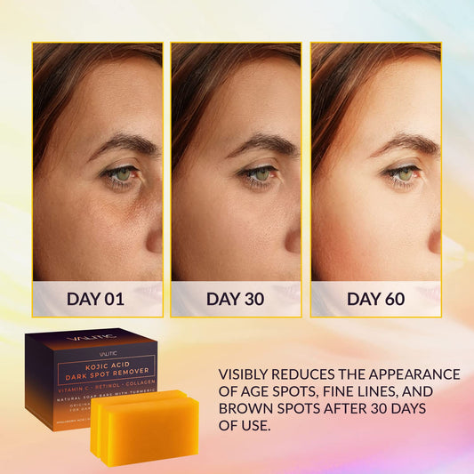 VALITIC Kojic Acid Dark Spot Remover Soap