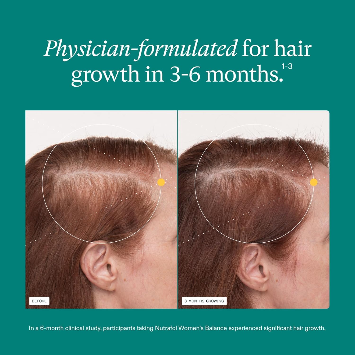 Nutrafol Women’s Hair Growth Supplements