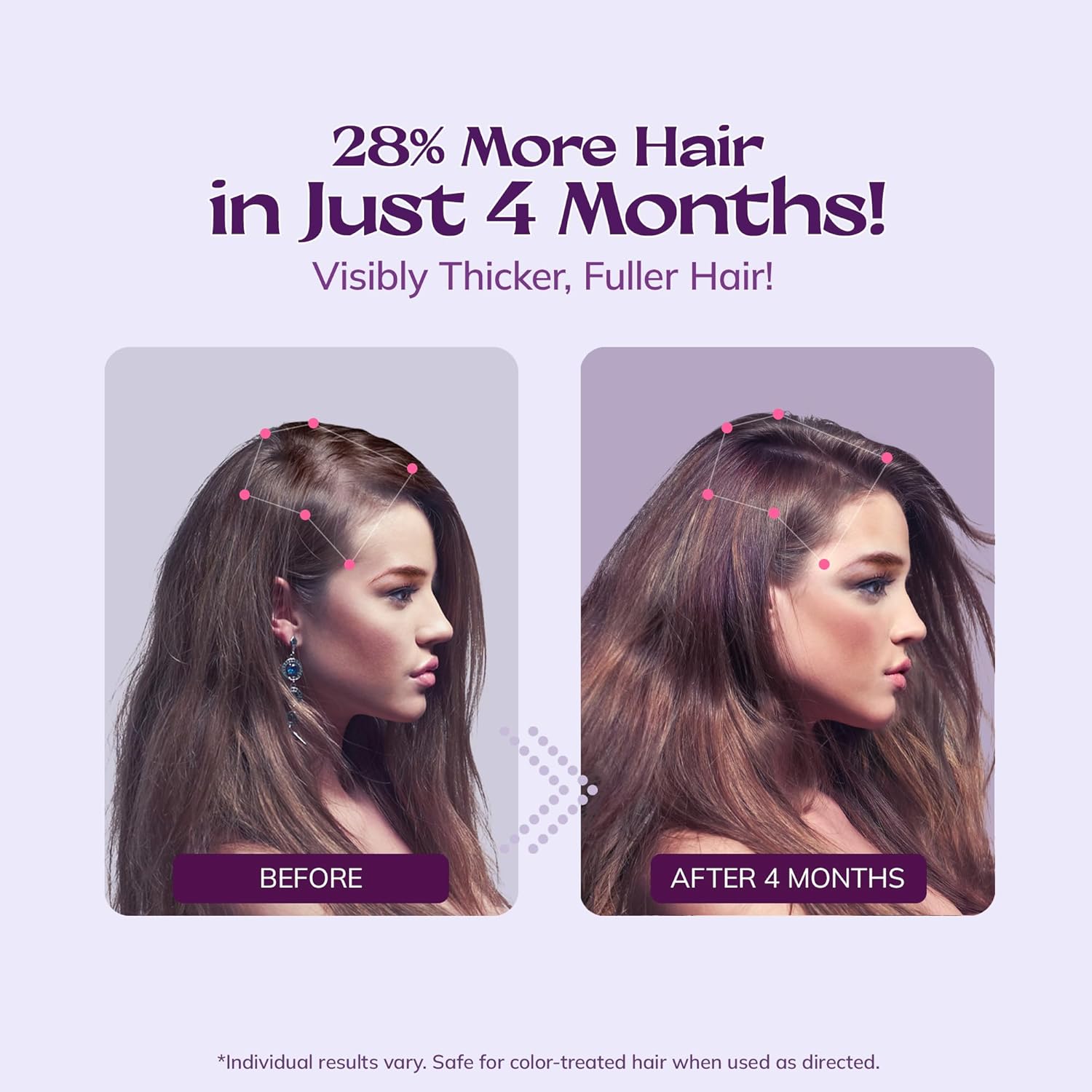 Women’s 5% Minoxidil Spray for Hair Growth