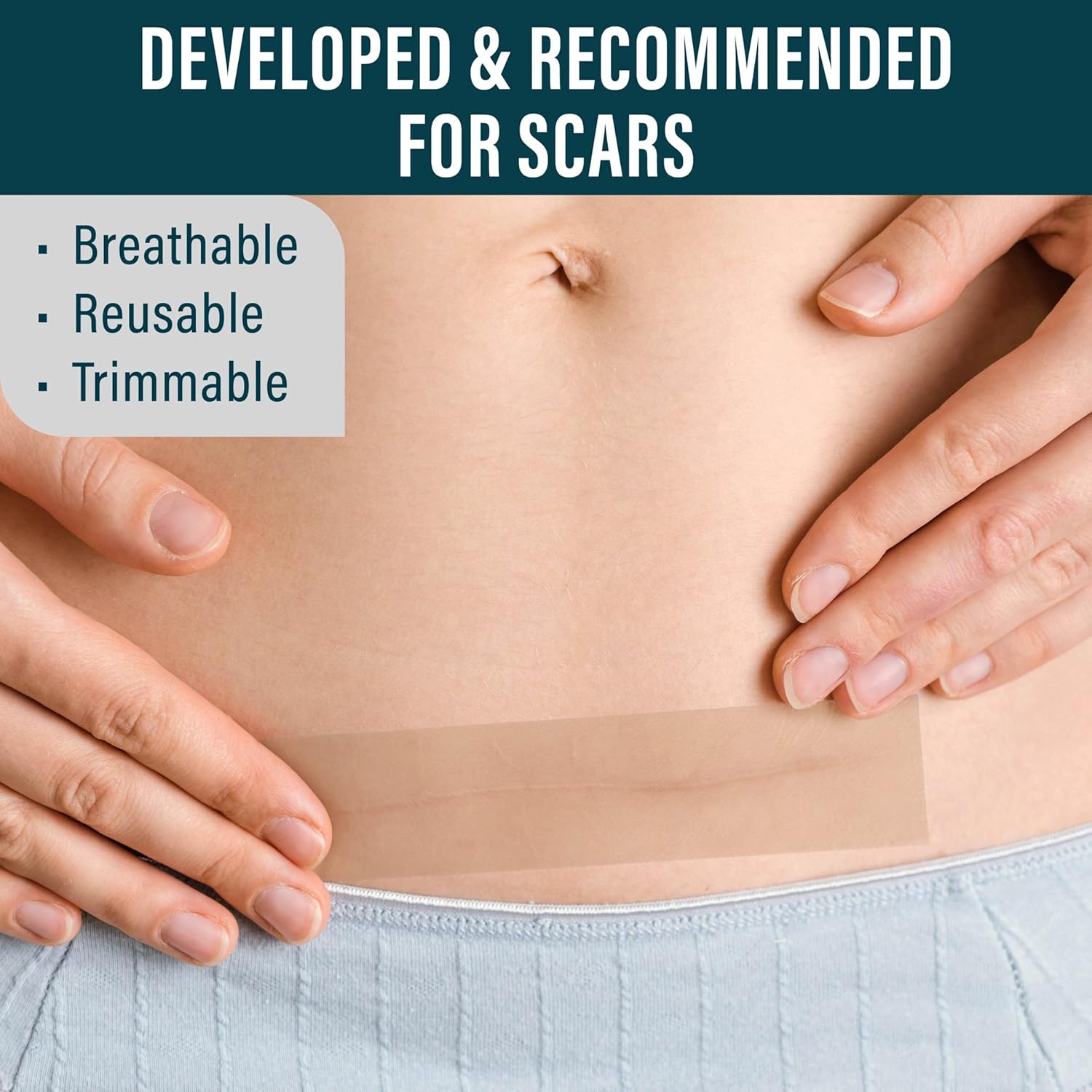 NUVADERMIS Silicone Scar Tape for Surgical Scars