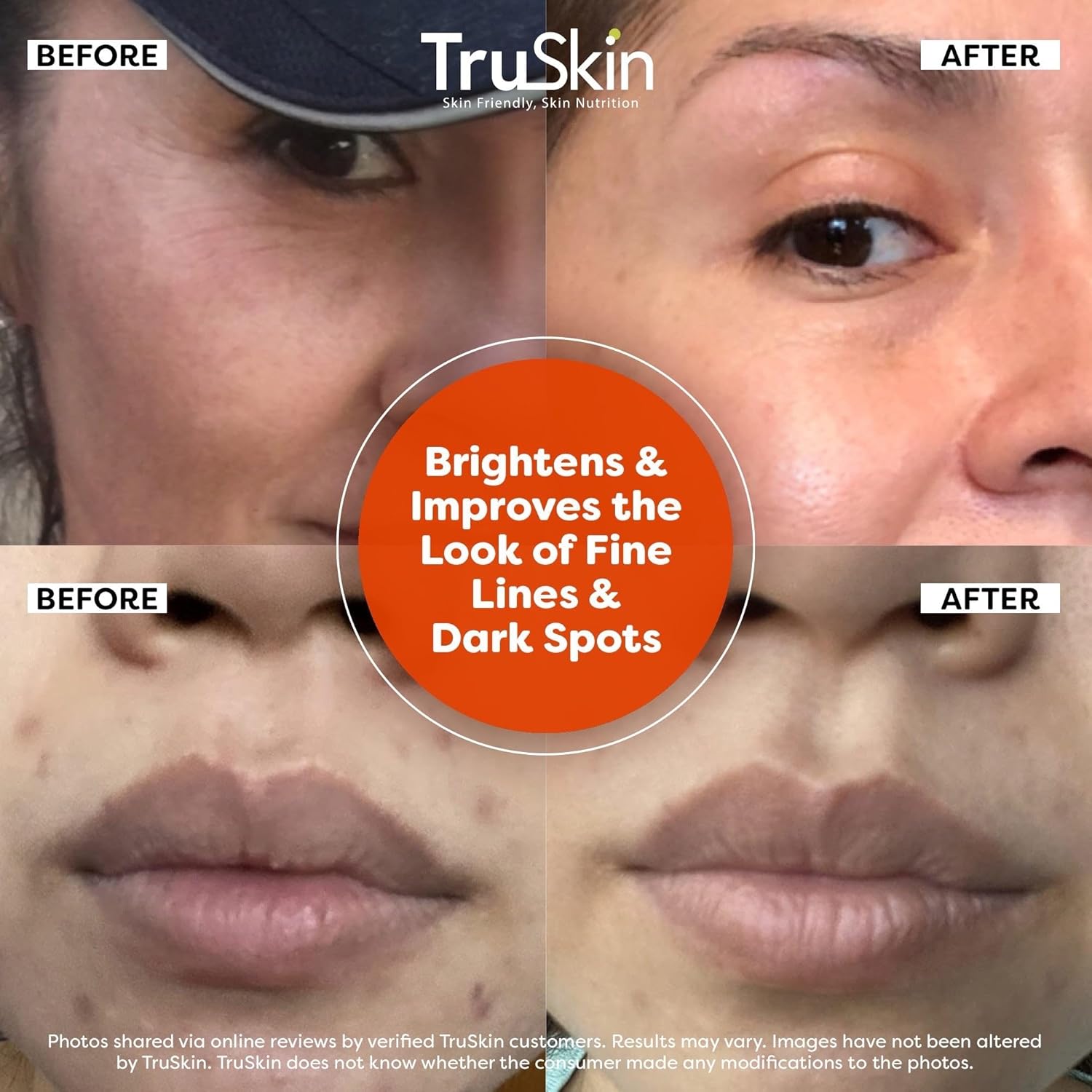 TruSkin Vitamin C Face Serum with Hyaluronic Acid