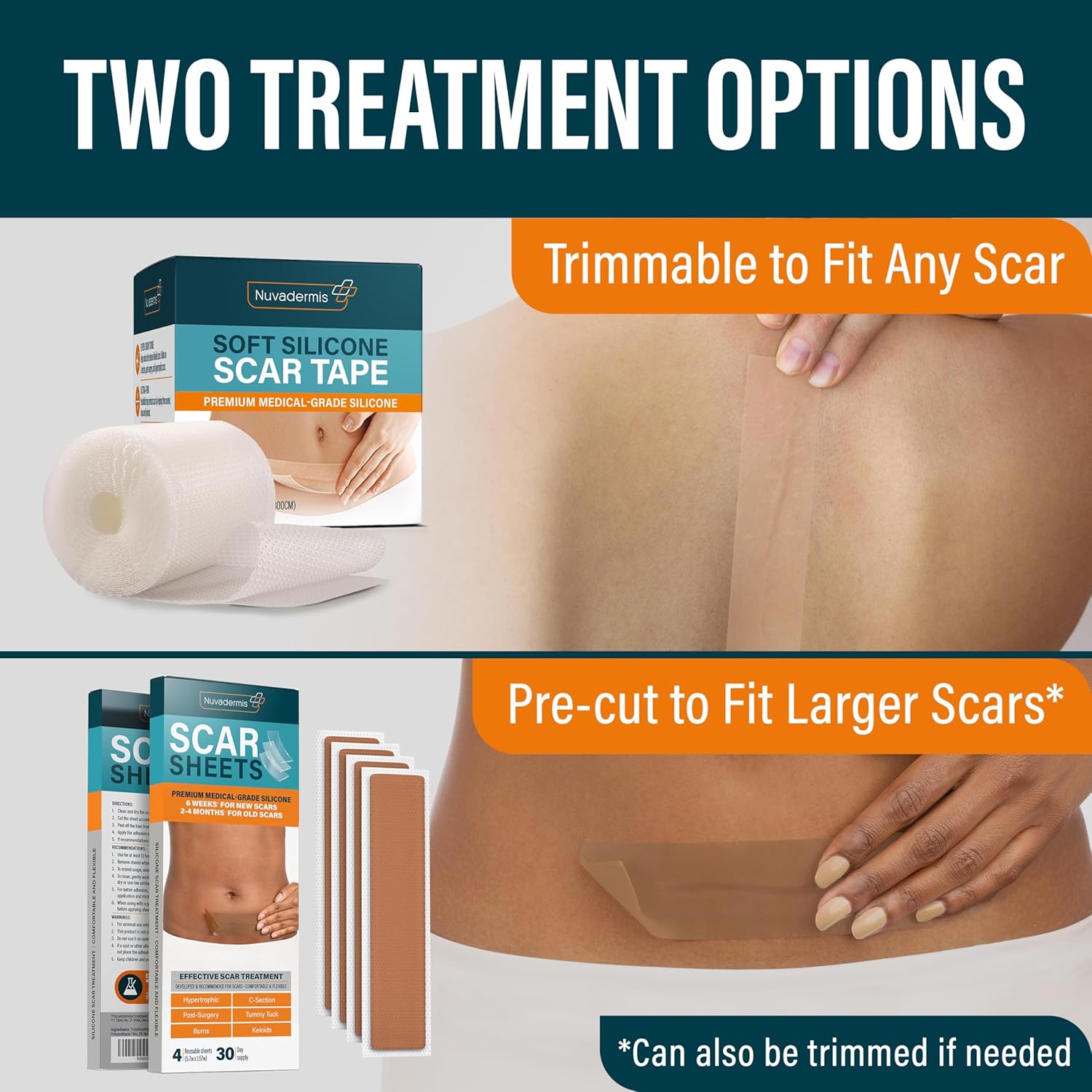 NUVADERMIS Silicone Scar Tape for Surgical Scars