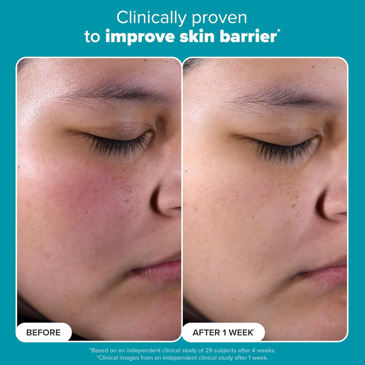 Paula's Choice SKIN PERFECTING BHA Liquid Exfoliant